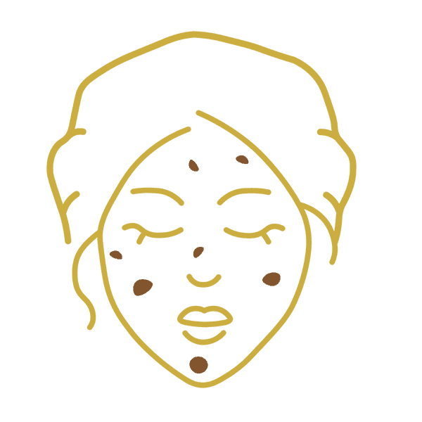 Melasma/Pigmentation