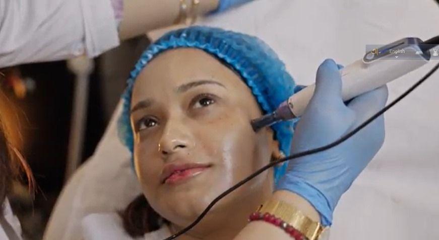 Microneedling with Radio Frequency (MNRF)