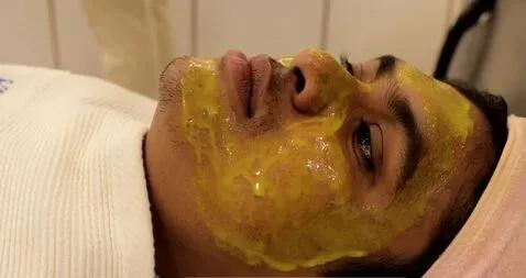 Melasma/Pigmentation